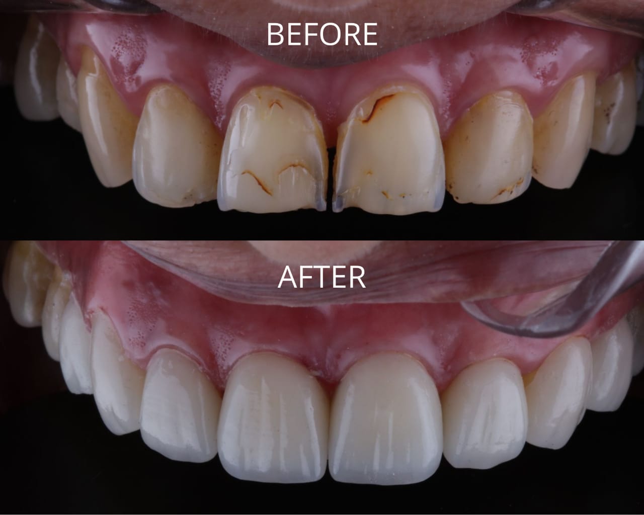 SHINE DENTAL CLINIC VENNIYUR