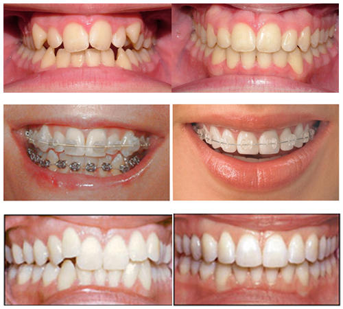 SHINE DENTAL CLINIC VENNIYUR